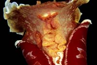 T-Bohn-D001R-0051-A-PI-Anilao